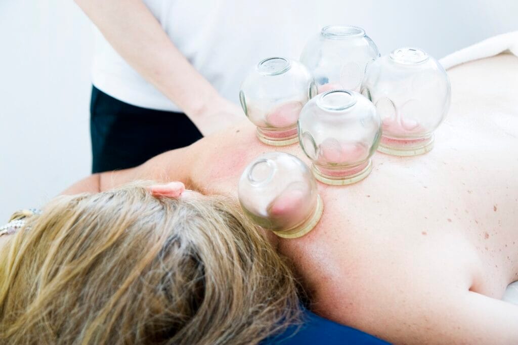 cupping